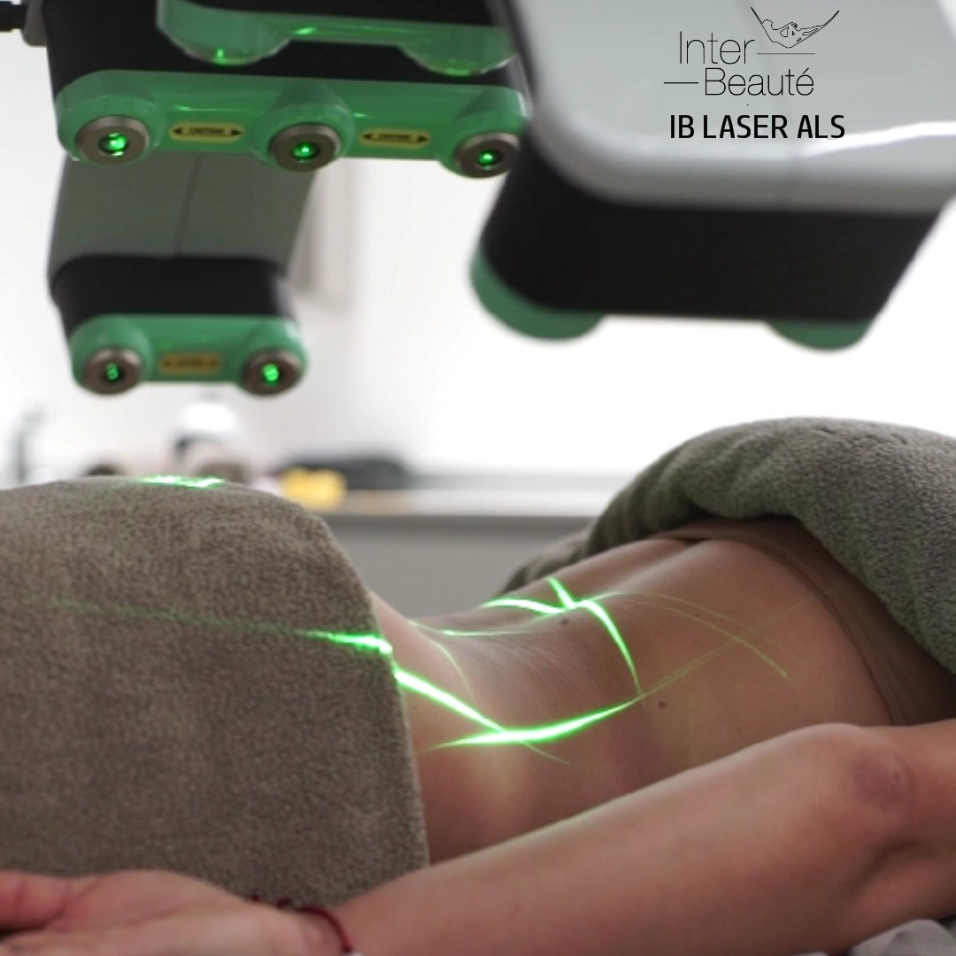LASER ALS